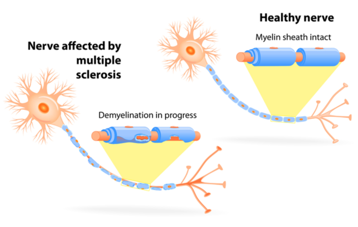 myelin sheath diagram