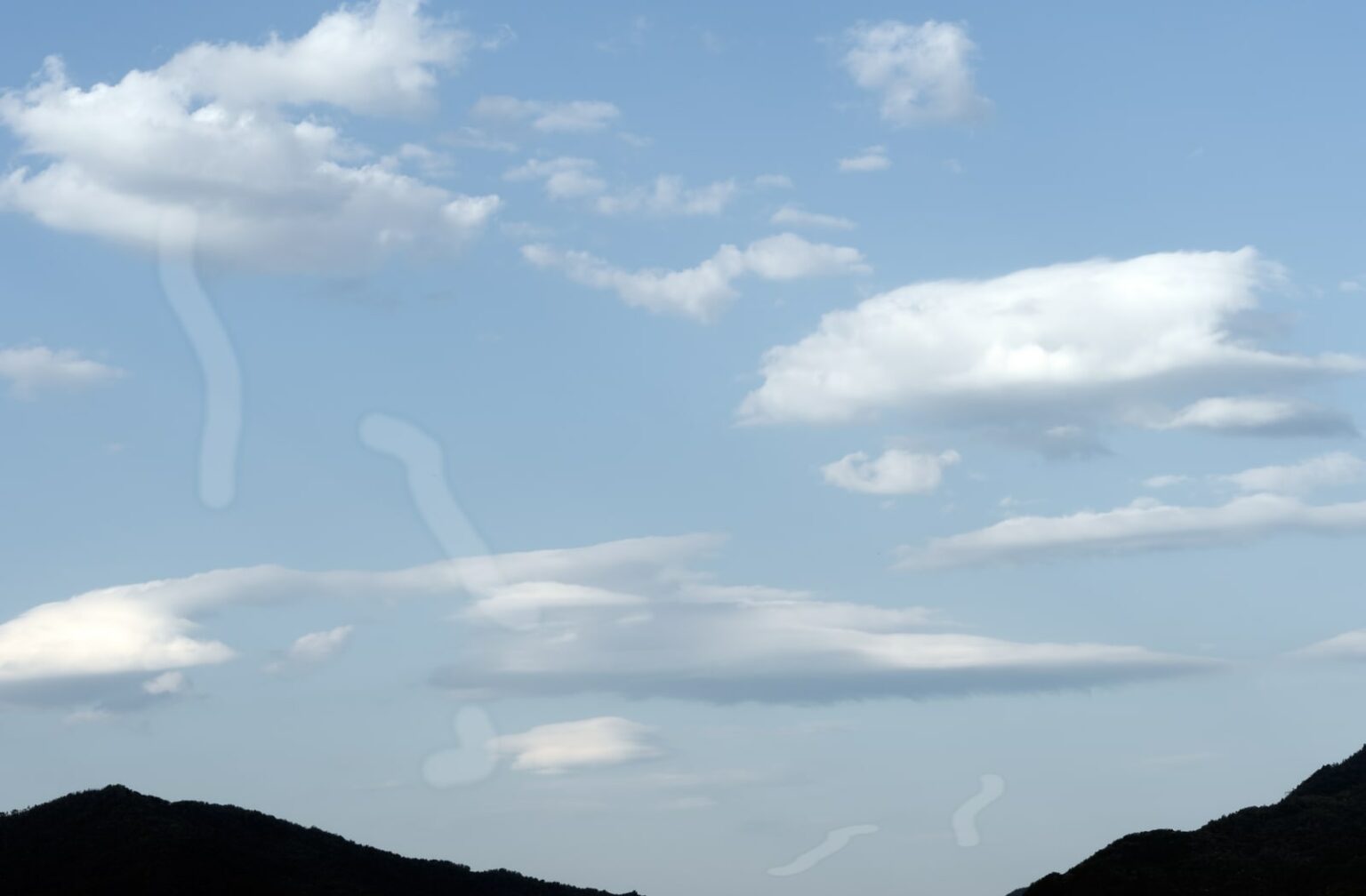 Does Rubbing Your Eyes Cause Floaters? Calgary