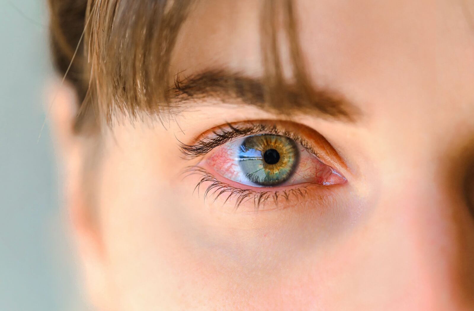 Closeup photo of someone's red eye, with a blurred background.